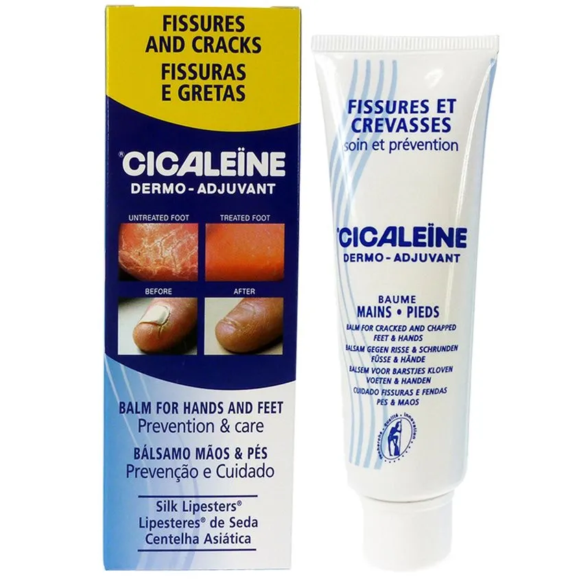 Cicaleine fisuras pies y manos